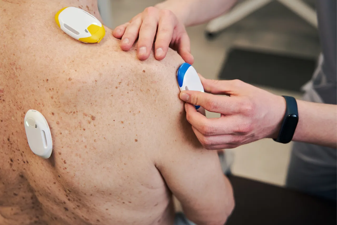 Allergologie Graal-Müritz, allergische Hautreaktion am Unterarm eines Patienten